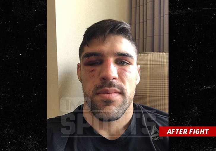 UFC’s Vicente Luque My Face Is Wedding Planner’s Nightmare … After Barberena Fight